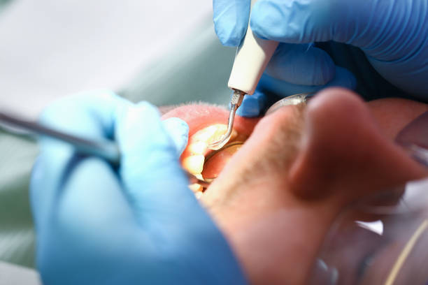 Best Emergency Broken Tooth Repair in Imperial, CA